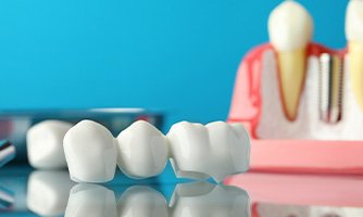 Sample dental bridge and implant on reflective surface with light blue background