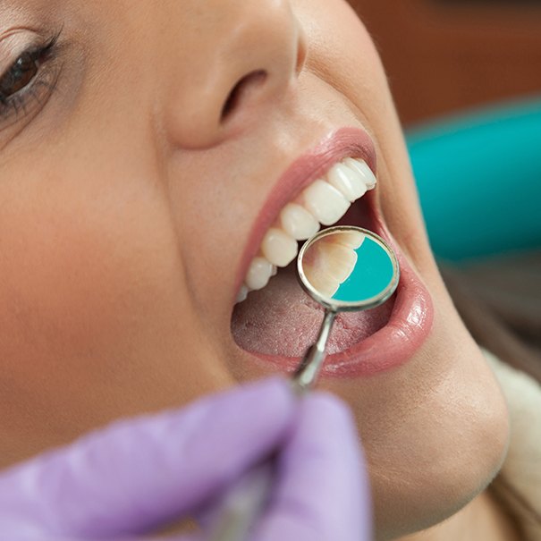 Dentist checking patient's smile after metal free dental restorations