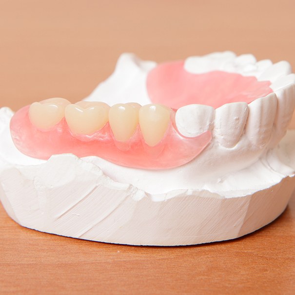 Model smile with partial denture