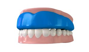 Model of an athletic mouthguard