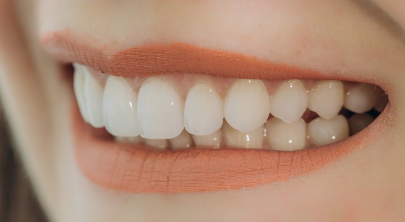 A close-up of a smile with porcelain veneers